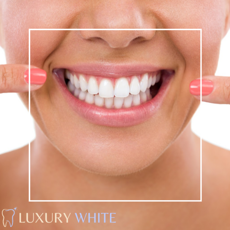 PAP + Smile - Luxury White - Whitening Pen
