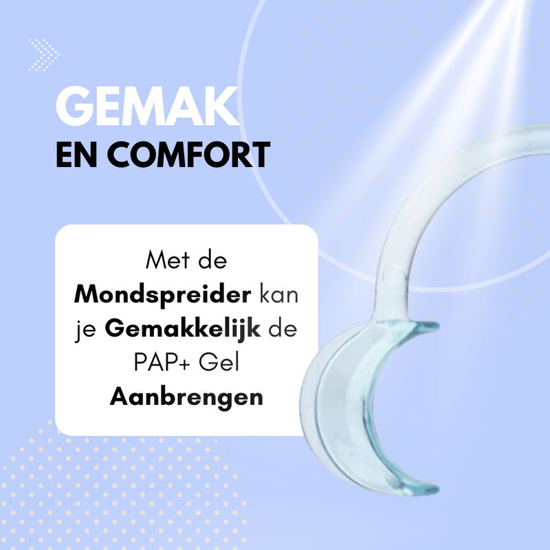 Bleken met de Mondspreider